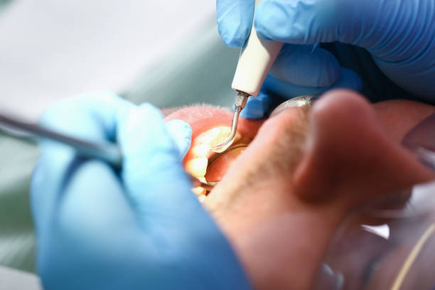 Best Emergency Care for Gum Disease in Saltville, VA