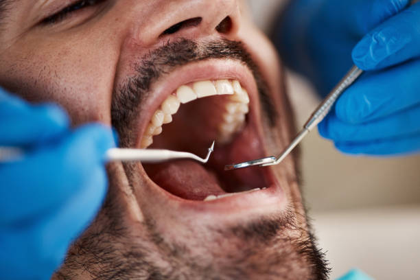Best Weekend Emergency Dental Services in Saltville, VA
